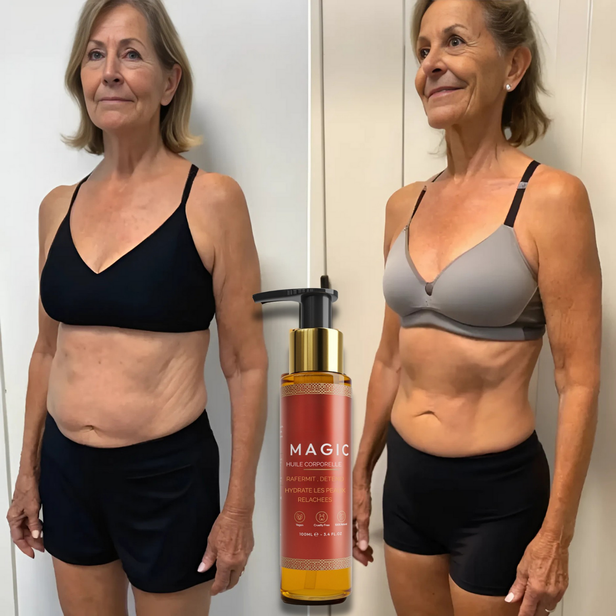 Nelvo – Aceite Corporal Rejuvenecedor