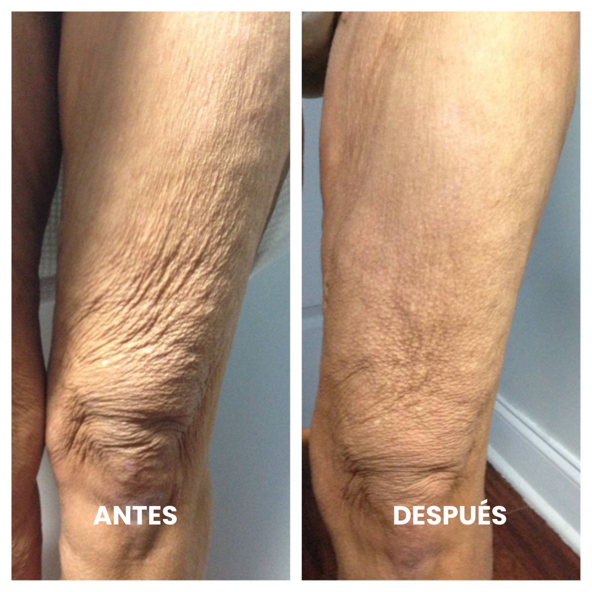 Nelvo – Aceite Corporal Rejuvenecedor