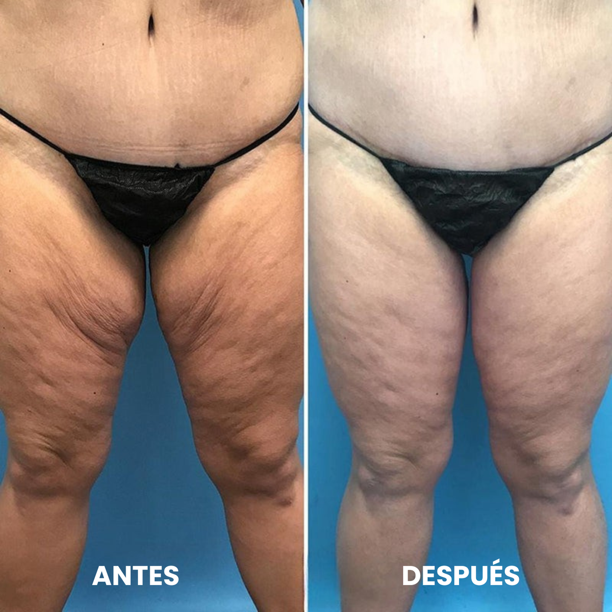 Nelvo – Aceite Corporal Rejuvenecedor